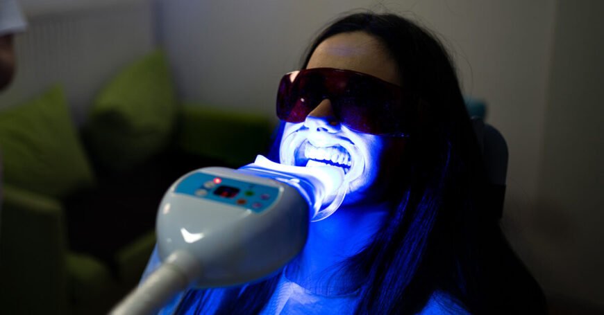 Teeth-White-Laser