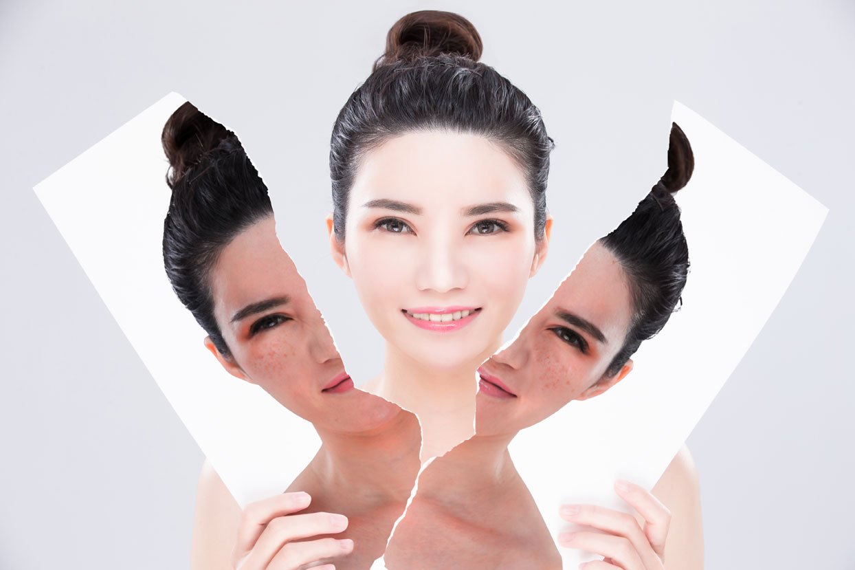 Best Skin Whitening Treatment in Bangalore