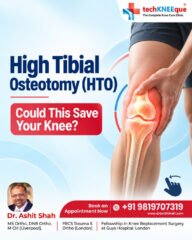 What-if-you-could-relieve-knee-pain-without-replacing-your-knee-🦵High-Tibial-Osteotomy-HTO-is